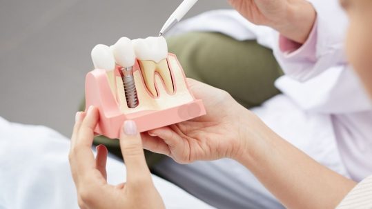 estética dental