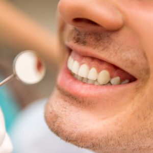 estética dental