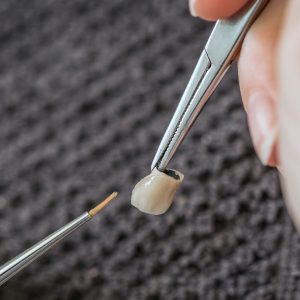 estética dental