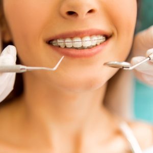 estética dental