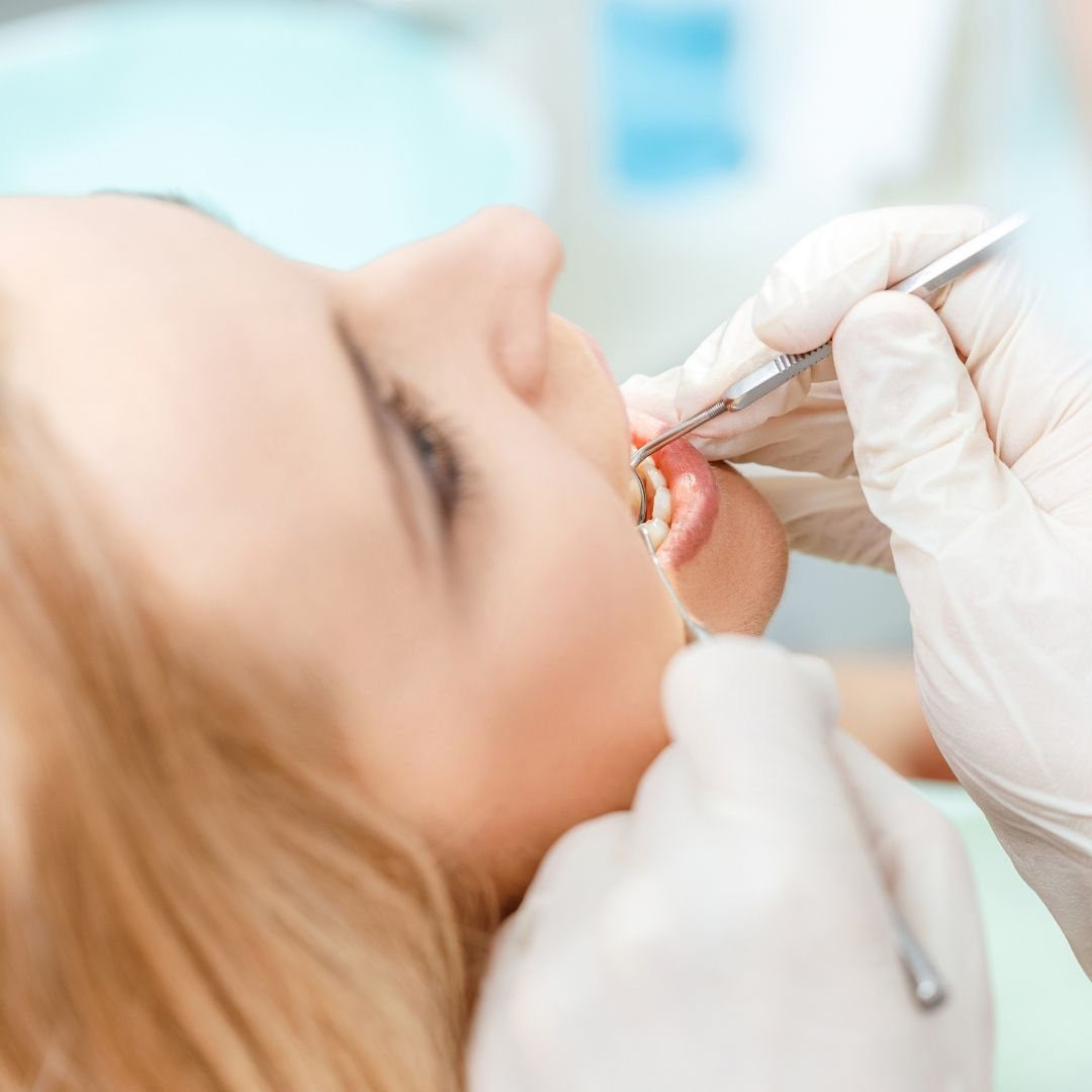 endodoncia