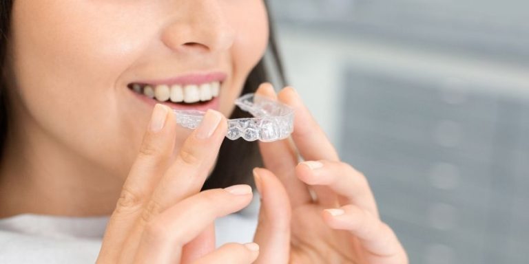 Ortodoncia convencional o Técnica Invisalign