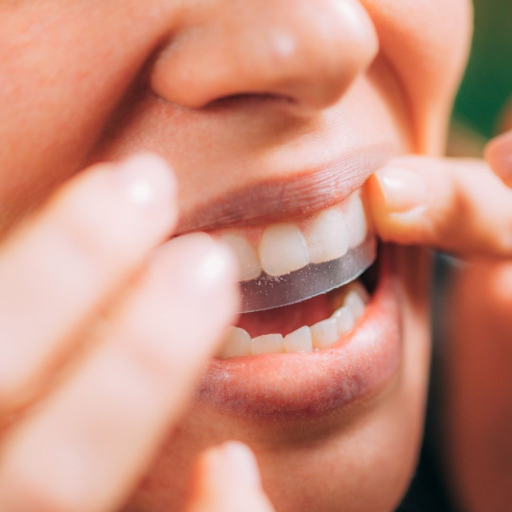 blanqueamiento dental