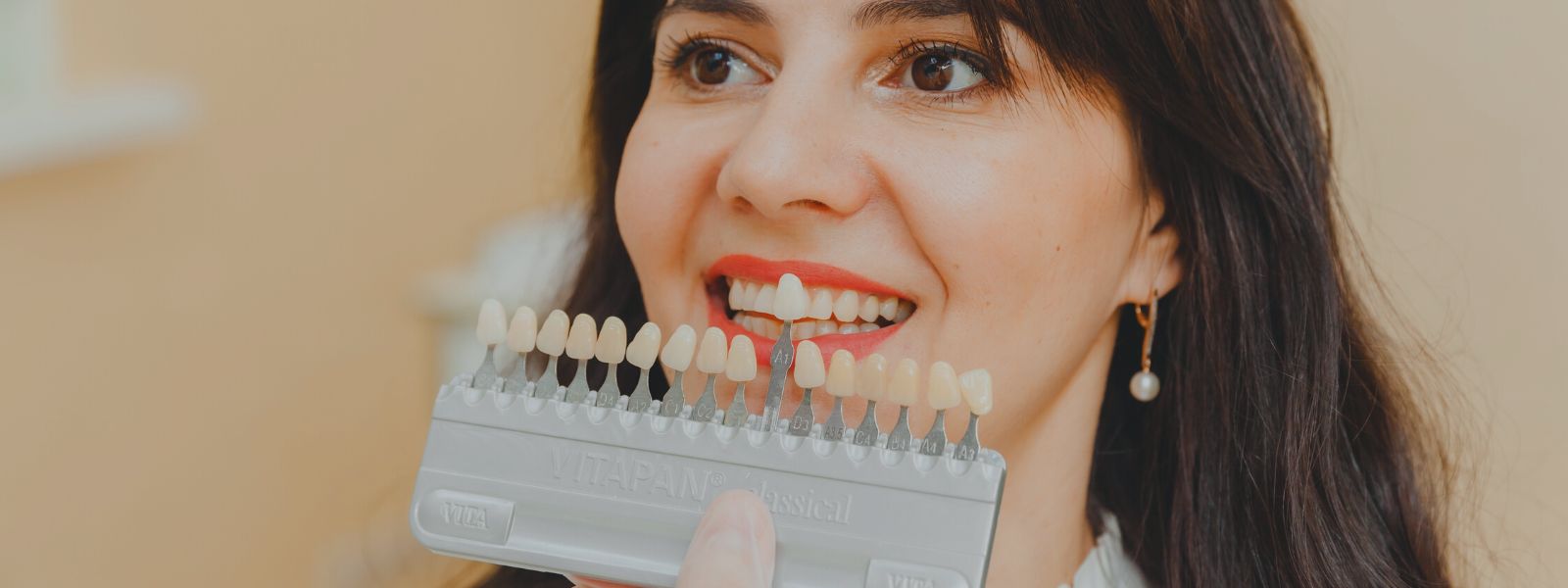blanqueamiento dental