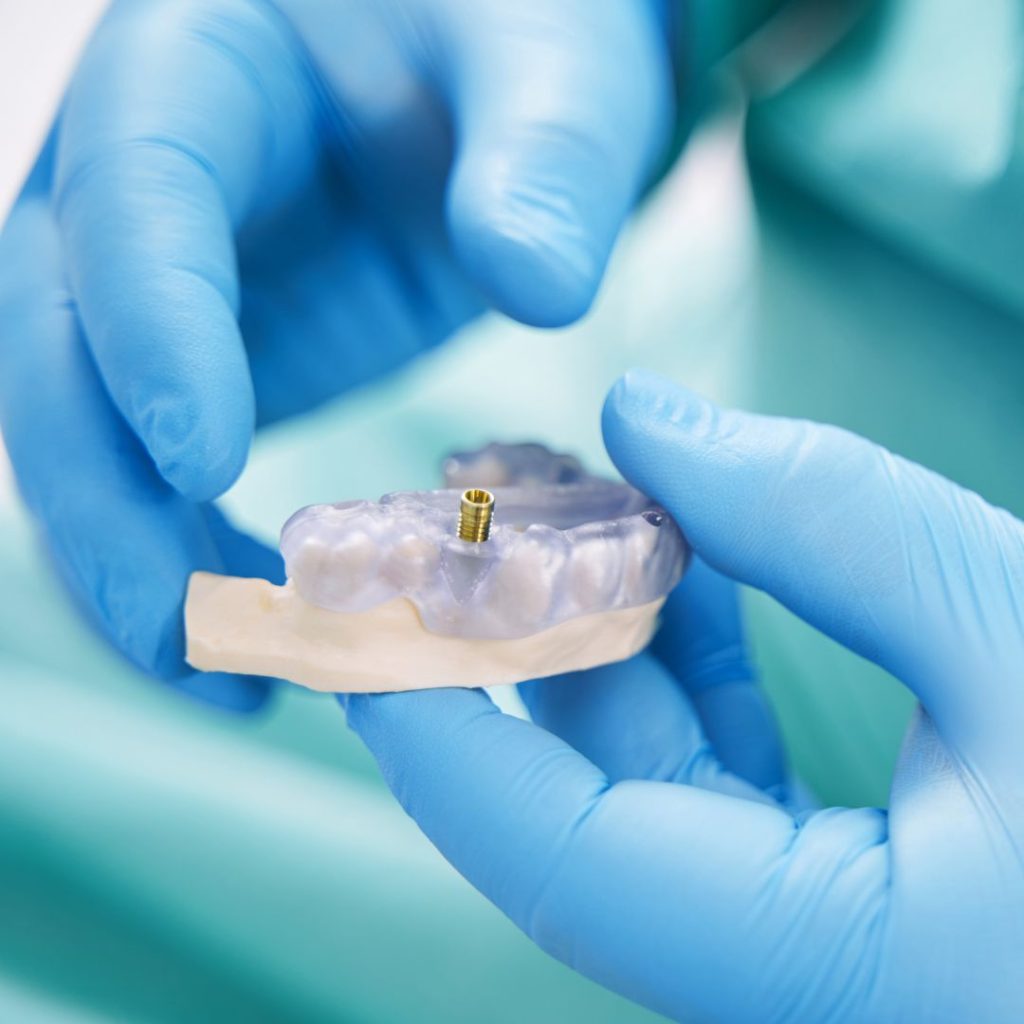 osteointegración