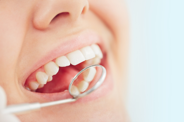 Limpieza dental profesional
