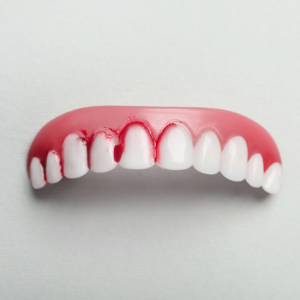 Periodontitis y retracción de encías