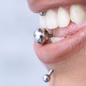 Piercing y retracción de encías