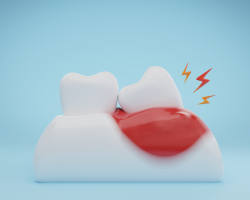 Encías rojas e inflamadas y salud cardiovascular