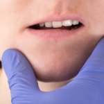 Maloclusión Dental