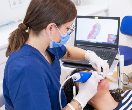 Escaner Intraoral